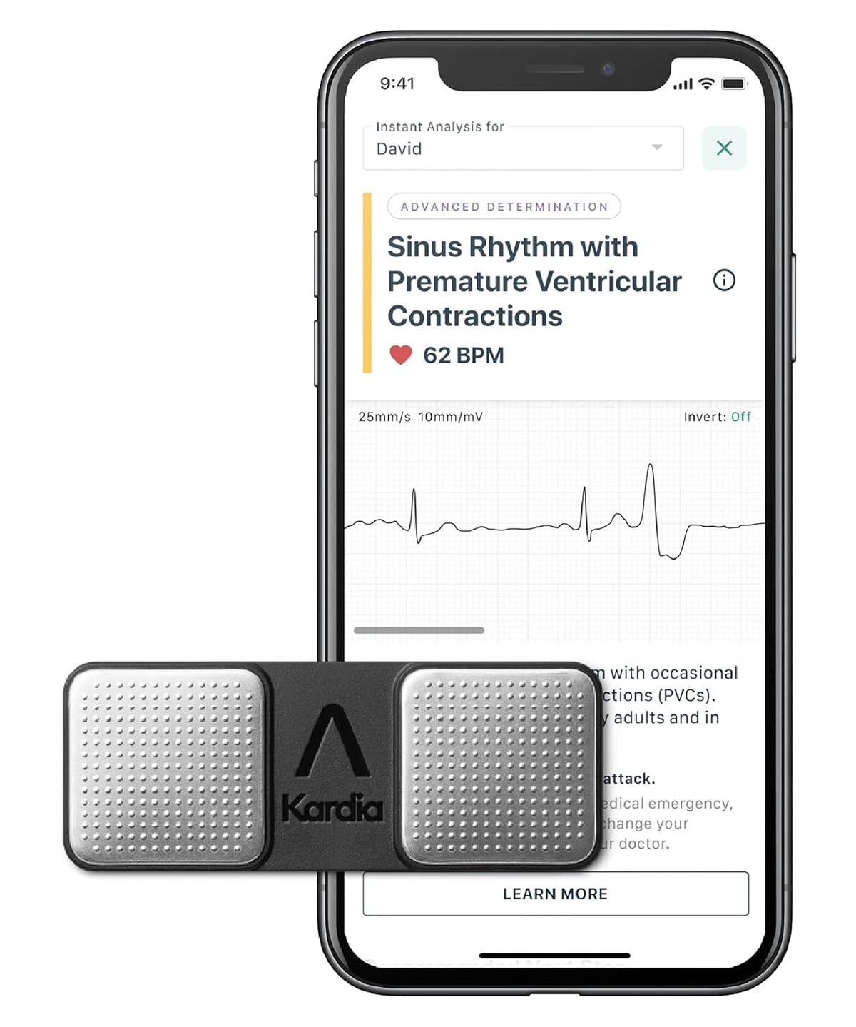 Single Lead EKG S1128