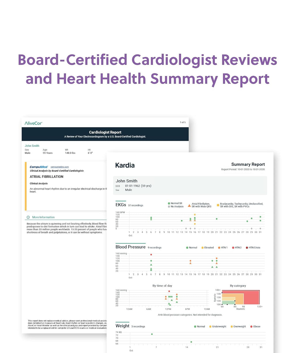 Single Lead EKG S1128